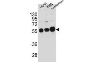 Western Blotting (WB) image for anti-Calcium/calmodulin-Dependent Protein Kinase IG (CAMK1G) antibody (ABIN3003081) (CAMK1G Antikörper)