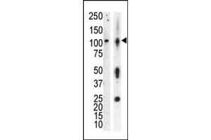 Western blot analysis of anti-PKCnu Pab (ABIN391014 and ABIN2841186) in lysate of HL60 cells stimulated with A (lane A) and mouse brain tissue lysate (lane B). (PRKD3 Antikörper  (AA 352-384))
