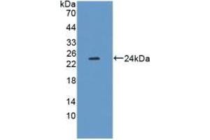 Detection of Recombinant XDH, Mouse using Polyclonal Antibody to Xanthine Dehydrogenase (XDH)