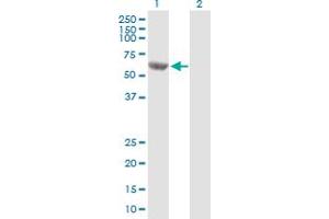 Western Blot analysis of MCCC2 expression in transfected 293T cell line by MCCC2 MaxPab polyclonal antibody. (MCCC2 Antikörper  (AA 1-563))