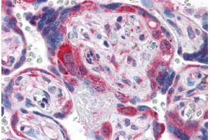 Human Placenta (formalin-fixed, paraffin-embedded) stained with PDGFRA antibody ABIN337400 at 5 ug/ml followed by biotinylated goat anti-rabbit IgG secondary antibody ABIN481713, alkaline phosphatase-streptavidin and chromogen. (PDGFRA Antikörper  (C-Term))