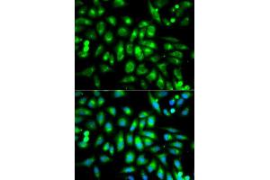 Immunofluorescence analysis of MCF7 cell using CHRM2 antibody. (Muscarinic Acetylcholine Receptor M2 Antikörper  (AA 208-388))