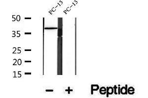 Western blot analysis of extracts of PC-13 cells, using URAT1 antibody. (SLC22A12 Antikörper)