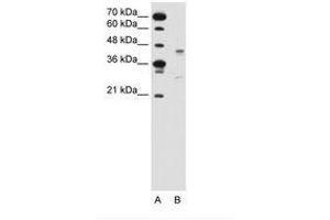 Image no. 2 for anti-G Protein-Coupled Receptor 161 (GPR161) (AA 201-250) antibody (ABIN6736635) (GPR161 Antikörper  (AA 201-250))
