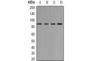 Western blot analysis of YT521-B expression in MCF7 (A), Jurkat (B), mouse brain (C), rat brain (D) whole cell lysates. (YTHDC1 Antikörper)