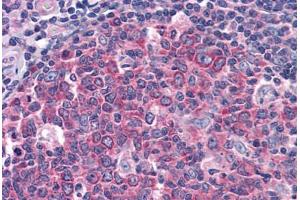 Human Tonsil: Formalin-Fixed, Paraffin-Embedded (FFPE) (IDE Antikörper  (AA 349-605))