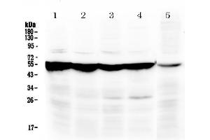 Western blot analysis of PAH using anti-PAH antibody . (Phenylalanine Hydroxylase Antikörper  (AA 71-208))
