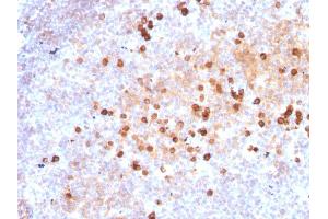 Formalin-fixed, paraffin-embedded human Tonsil stained with Purified IgM Mouse Monoclonal Antibody (IM373). (IGHM Antikörper)