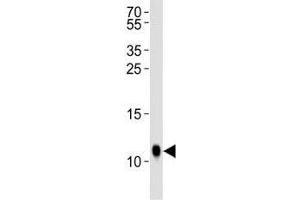 Western blot analysis of lysate from Drosophila tissue lysate using SUMO antibody diluted at 1:1000. (SUMO Antikörper  (AA 37-66))