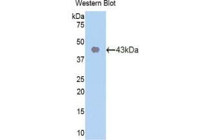 Western blot analysis of the recombinant protein. (CDK2 Antikörper  (AA 93-211))
