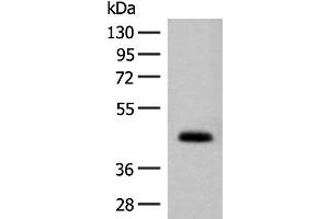 Western blot analysis of Mouse small intestines tissue lysate using GPA33 Polyclonal Antibody at dilution of 1:200 (GPA33 Antikörper)
