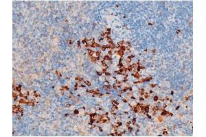 Immunohistochemistry (IHC) image for anti-Spleen tyrosine Kinase (SYK) (pTyr348) antibody (ABIN6255895)
