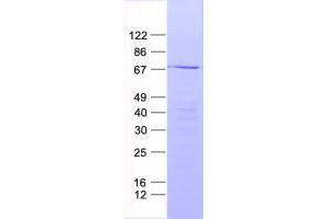 Validation with Western Blot (NMDA Receptor Synaptonuclear Signaling and Neuronal Migration Factor (NSMF) protein (His tag))