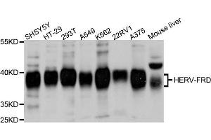 Western blot analysis of extracts of various cell lines, using ERVFRD-1 antibody. (HERV-FRD Provirus Ancestral Env Polyprotein (Herv-frd) (AA 16-250) Antikörper)