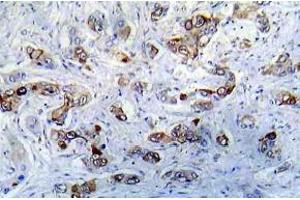 Immunohistochemistry (IHC) analyzes of CaMK2-a antibody in paraffin-embedded human A431 tissue. (CAMK2A Antikörper)
