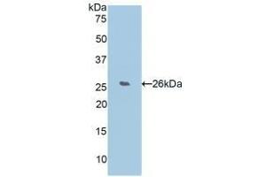 Detection of Recombinant WISP2, Human using Polyclonal Antibody to WNT1 Inducible Signaling Pathway Protein 2 (WISP2) (WISP2 Antikörper  (AA 24-250))