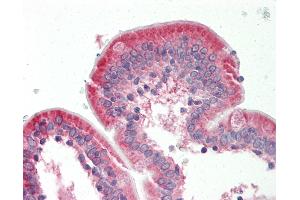 Human Small Intestine: Formalin-Fixed, Paraffin-Embedded (FFPE). (NET1 Antikörper  (AA 288-337))