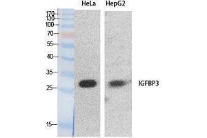 Western Blotting (WB) image for anti-Insulin-Like Growth Factor Binding Protein 3 (IGFBP3) (Internal Region) antibody (ABIN3178534) (IGFBP3 Antikörper  (Internal Region))