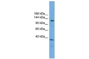 EIF4ENIF1 antibody used at 1 ug/ml to detect target protein. (EIF4ENIF1 Antikörper  (N-Term))