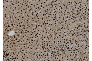 ABIN6273271 at 1/100 staining Rat liver tissue by IHC-P. (NAT10 Antikörper  (Internal Region))