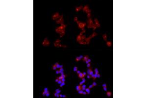 Immunofluorescence analysis of SH-SY5Y cells using G Rabbit pAb (ABIN6131686, ABIN6140882, ABIN6140883 and ABIN6214785) at dilution of 1:350 (40x lens). (GABBR1 Antikörper  (AA 200-460))