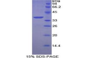 SDS-PAGE analysis of Chicken Annexin V Protein.