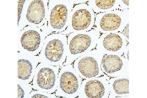 IHC analysis of BUB1B using anti-BUB1B antibody (ABIN7600962). (BUB1B Antikörper  (AA 26-448))