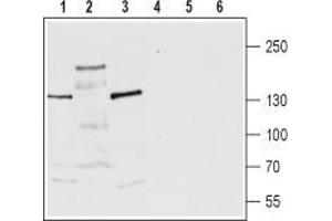 Western blot analysis of rat brain membrane (lanes 1 and 4), rat brain lysate (lanes 2 and 5) and mouse brain lysate (lanes 3 and 6): - 1-3. (TRPM3 Antikörper  (1st Extracellular Loop))