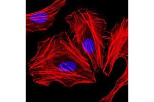 Immunofluorescence analysis of HeLa cells. (CEBPA Antikörper)