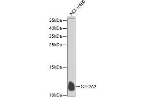 Western blot analysis of extracts of NCI-H460 cells using GTF2A2 Polyclonal Antibody at dilution of 1:1000.
