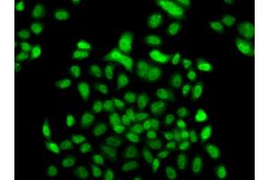 Immunofluorescence analysis of A549 cells using FBXO7 antibody.