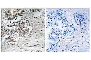 Immunohistochemistry analysis of paraffin-embedded human prostate carcinoma tissue using Claudin 7 (epitope around residue 210) antibody. (Claudin 7 Antikörper  (Tyr210))