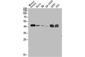 Western blot analysis of mouse-brain HELA KB SH-SY5Y 293T 3T3 lysis using MAGE-C2 antibody. (MAGEC2 Antikörper  (Internal Region))