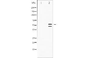 Western blot analysis of SAPK/JNK phosphorylation expression in Anisomycin treated HeLa whole cell lysates,The lane on the left is treated with the antigen-specific peptide. (SAPK, JNK (pThr183) Antikörper)