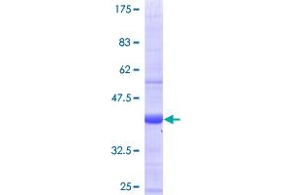 RAB28 Protein (AA 1-95) (GST tag)