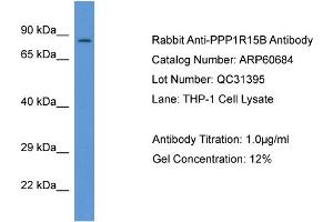 Western Blotting (WB) image for anti-Protein Phosphatase 1, Regulatory Subunit 15B (PPP1R15B) (C-Term) antibody (ABIN2774292)