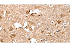 Immunohistochemistry of paraffin-embedded Human brain using CAPG Polyclonal Antibody at dilution of 1:40 (CAPG Antikörper)