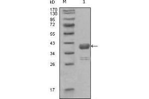 Western blot analysis using ABL1 mouse mAb against truncated GST-ABL1 recombinant protein (1).