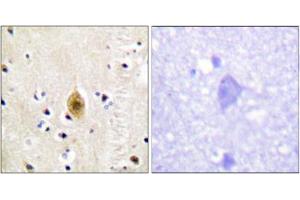 Immunohistochemical staining of paraffin-embedded human brain tissue reacted with STK4/STK3 (phospho T183) polyclonal antibody  at 1:50-1:100 dilution. (STK4 Antikörper  (pThr183))
