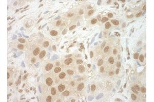 anti-Nuclear Cap Binding Protein Subunit 2 (NCBP2) (AA 106-156) antibody