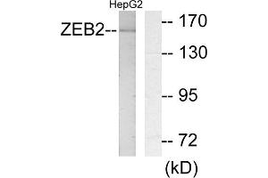 Western blot analysis of extracts from HepG2 cells, using ZEB2 antibody.