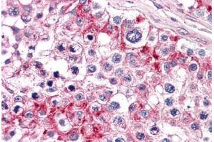 Human Testis: Formalin-Fixed, Paraffin-Embedded (FFPE) (TLN1 Antikörper  (AA 1052-1150))