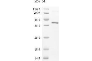 Fibronectin 1 (FN1) (AA 1-353) protein (His tag)