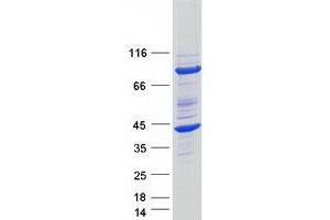 Validation with Western Blot