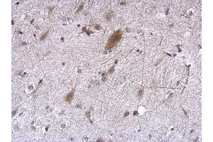IHC-P Image EEF1E1 antibody [N1C3] detects EEF1E1 protein at cytoplasm on mouse fore brain by immunohistochemical analysis. (EEF1E1 Antikörper)