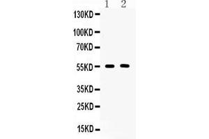 Western blot analysis of CD147/Emmprin using anti-CD147/Emmprin antibody .