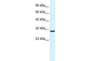 WB Suggested Anti-FLJ20729 Antibody Titration:  1. (FLJ20729 (C-Term) Antikörper)