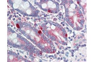 MED4 antibody was used for immunohistochemistry at a concentration of 4-8 ug/ml. (MED4 Antikörper  (Middle Region))