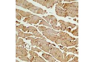 Immunohistochemical analysis of Beta3-tubulin staining in mouse skeletal muscle formalin fixed paraffin embedded tissue section. (TUBB3 Antikörper)