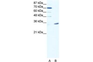 Western Blotting (WB) image for anti-Melanoma Antigen Family A, 9 (MAGEA9) antibody (ABIN2461754) (MAGEA9 Antikörper)